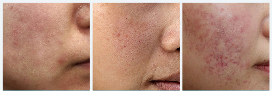 Ansiktsserum – Anti-Aging, Porförminskande, Upplysande & Återfuktande Ansiktskräm för Torr Hud
