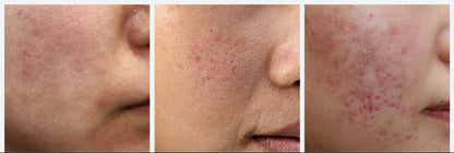Ansiktsserum – Anti-Aging, Porförminskande, Upplysande & Återfuktande Ansiktskräm för Torr Hud